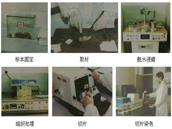 【醫學PPT課件】骨腫瘤病理知識  煤炭總醫院病理科楊連君第8頁