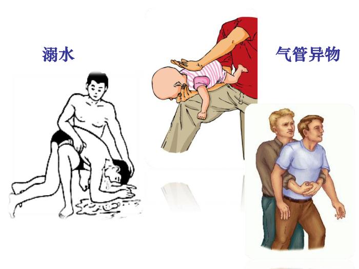 【醫學PPT課件】人工呼吸與心臟按壓-南京市兒童醫院-重癥醫學科-葛許華第10頁