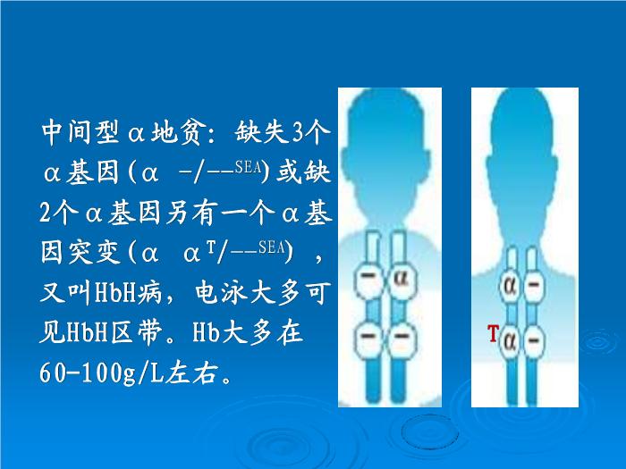 【醫學PPT課件】地中海貧血產前診斷意義與技術 解放軍303醫院血液科 尹曉林第5頁