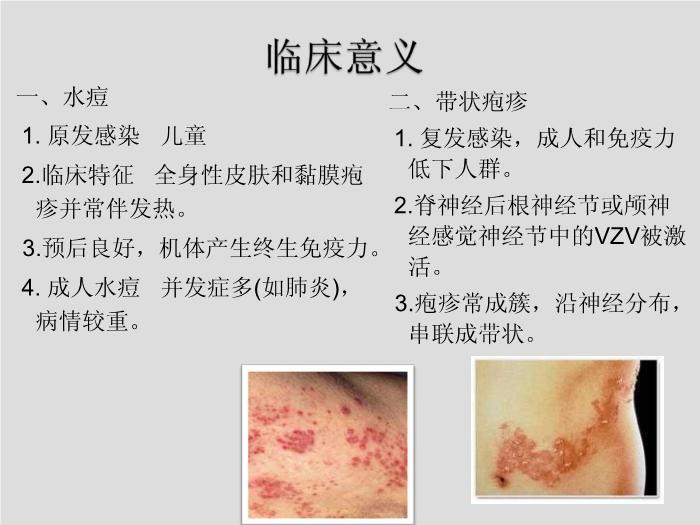 【醫學PPT課件】第27章 皰疹病毒 浙江大學附屬第一醫院陳瑜第12頁