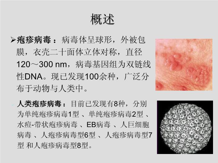 【醫學PPT課件】第27章 皰疹病毒 浙江大學附屬第一醫院陳瑜第2頁