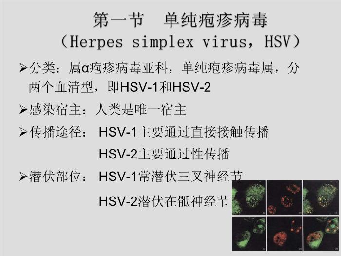 【醫學PPT課件】第27章 皰疹病毒 浙江大學附屬第一醫院陳瑜第4頁