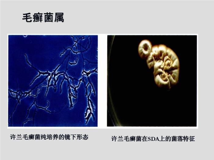 【醫學PPT課件】第21章 引起皮膚和軟組織感染的真菌