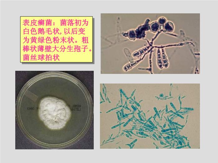 【醫學PPT課件】第21章 引起皮膚和軟組織感染的真菌