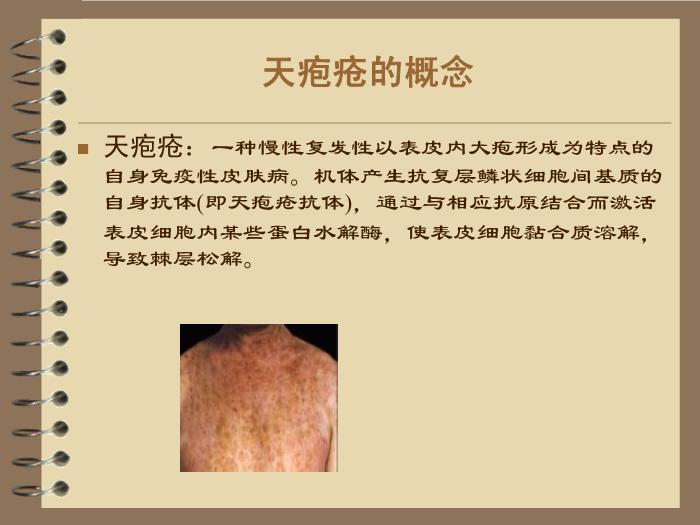 【醫學PPT課件】護理查房—天皰瘡 風濕內科陳省英第4頁