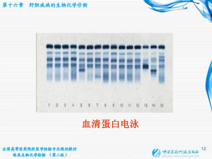 【醫學PPT課件】肝膽疾病的生物化學診斷第12頁