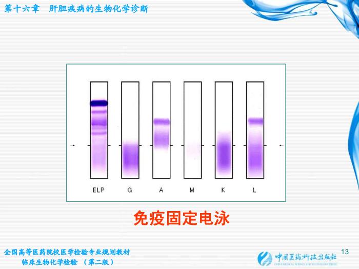 【醫學PPT課件】肝膽疾病的生物化學診斷第13頁