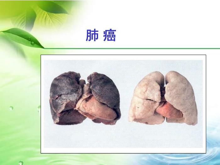【醫學PPT課件】健康生活遠離癌癥-中華社區衛生服務中心第7頁