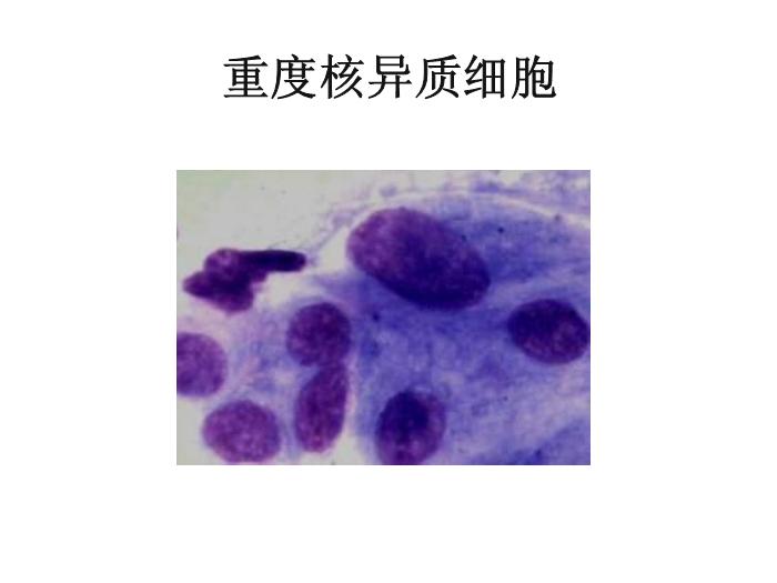 【醫學PPT課件】第八版診斷學 陰道分泌物第11頁