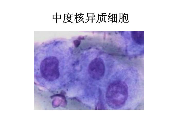 【醫學PPT課件】第八版診斷學 陰道分泌物第12頁
