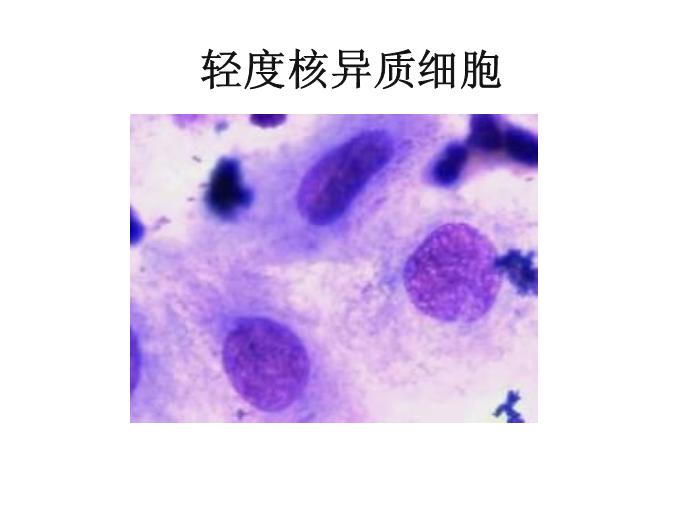 【醫學PPT課件】第八版診斷學 陰道分泌物第13頁
