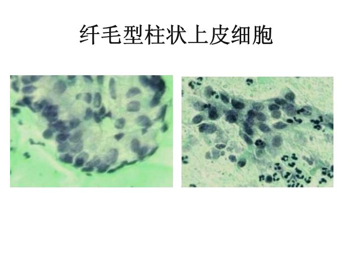 【醫學PPT課件】第八版診斷學 陰道分泌物第14頁