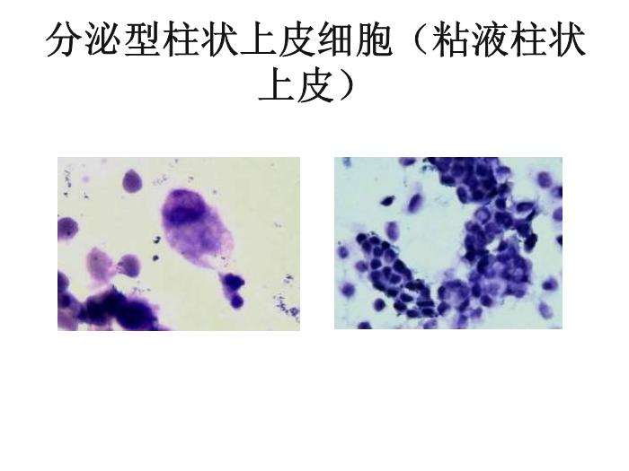 【醫學PPT課件】第八版診斷學 陰道分泌物第15頁