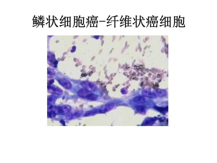 【醫學PPT課件】第八版診斷學 陰道分泌物第4頁