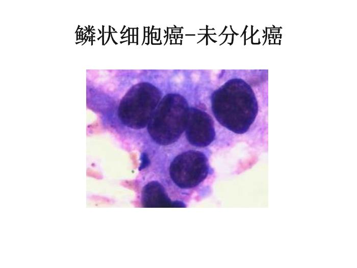 【醫學PPT課件】第八版診斷學 陰道分泌物第5頁