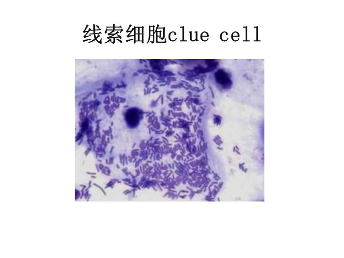 【醫學PPT課件】第八版診斷學 陰道分泌物第6頁