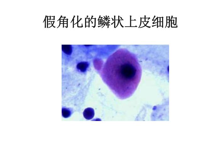 【醫學PPT課件】第八版診斷學 陰道分泌物第7頁