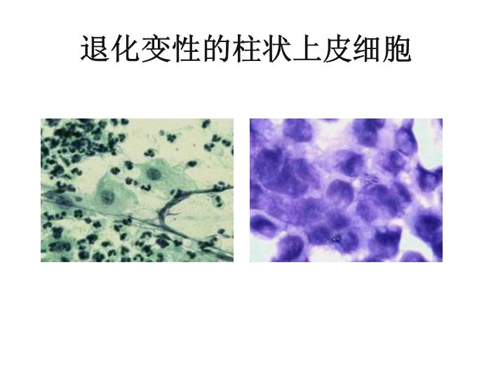 【醫學PPT課件】第八版診斷學 陰道分泌物第8頁