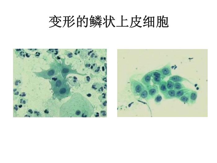 【醫學PPT課件】第八版診斷學 陰道分泌物第9頁