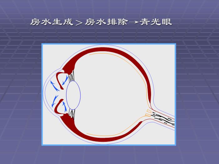 【醫學PPT課件】急性閉角型青光眼 黃驊市醫院眼科第11頁