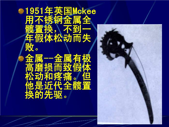 【醫學PPT課件】人工髖關節置換術 南京醫科大學第一附屬醫院骨科第4頁
