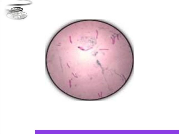 【醫學PPT課件】結核病 八年制兒科學PPT課件第12頁