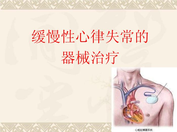 【醫學PPT課件】快速心律失常的射頻消融治療 青島思達中獅國際心肺血管醫院預覽圖（8）