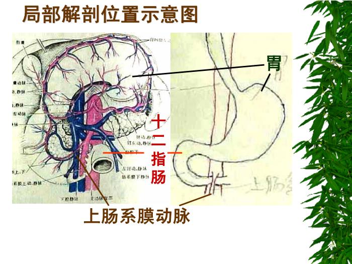 【醫學PPT課件】聯系解剖學知識思考臨床問題第9頁