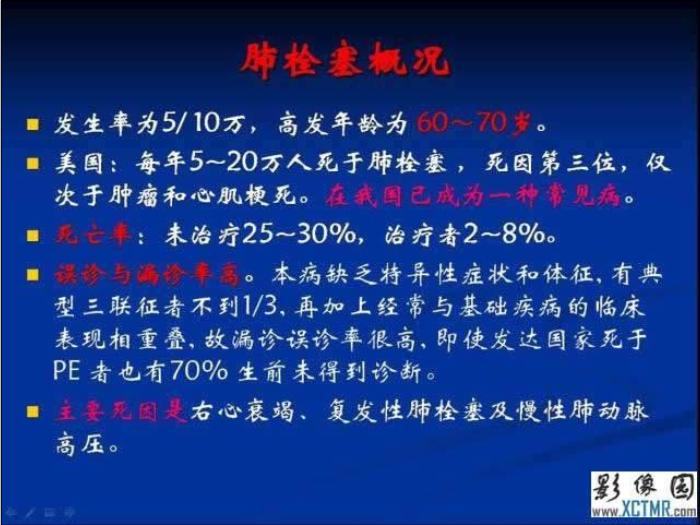 【醫學PPT課件】肺栓塞與肺梗死的影像學診斷_PPT課件第3頁