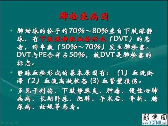 【醫學PPT課件】肺栓塞與肺梗死的影像學診斷_PPT課件第4頁