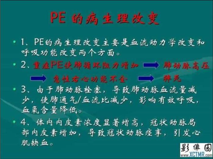 【醫學PPT課件】肺栓塞與肺梗死的影像學診斷_PPT課件第8頁