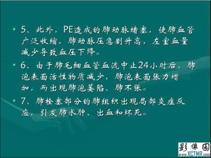 【醫學PPT課件】肺栓塞與肺梗死的影像學診斷_PPT課件第9頁