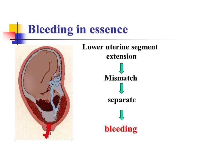 【醫學PPT課件】前置胎盤placenta previa課件第14頁