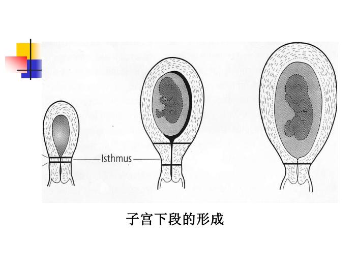 【醫學PPT課件】前置胎盤placenta previa課件第5頁