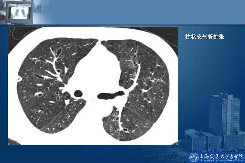 【醫學PPT課件】呼吸系統影像學診斷_PPT課件第8頁