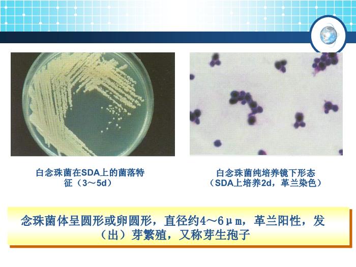 【醫學PPT課件】念珠菌病 傳染病學教學課件第7頁