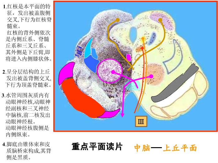 【醫學PPT課件】腦部重點平面讀片、切面第3頁