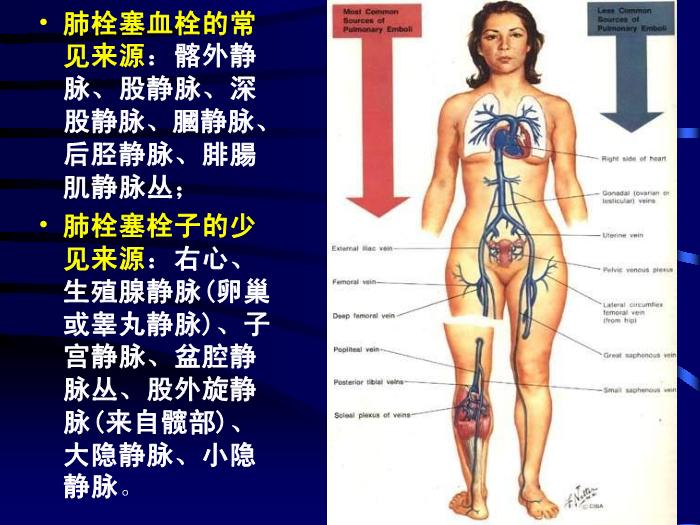 【醫學PPT課件】肺栓塞的診斷和治療-昆明市第一人民醫院呼吸科-鄭勤玲第6頁