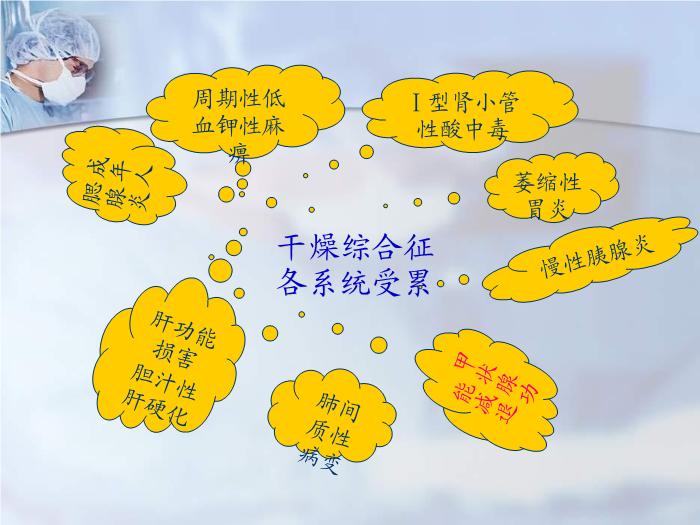 【醫學PPT課件】干燥綜合征合并甲狀腺疾病-福建醫科大學附屬第二醫院免疫內科第4頁