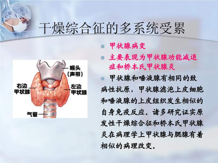 【醫學PPT課件】干燥綜合征合并甲狀腺疾病-福建醫科大學附屬第二醫院免疫內科第5頁