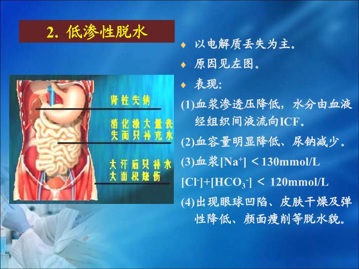 【醫學PPT課件】第13章  體液和酸堿平衡紊亂的生物化學檢驗 四川大學華西醫學中心 第12頁