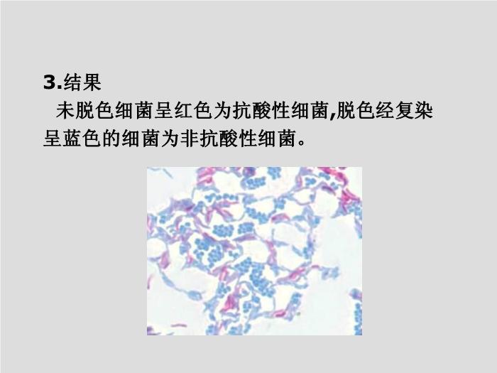 【醫學PPT課件】臨床微生物學檢驗技術 安徽醫科大學   徐元宏第12頁