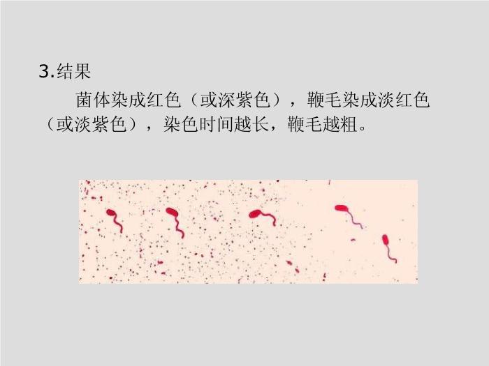 【醫學PPT課件】臨床微生物學檢驗技術 安徽醫科大學   徐元宏第15頁