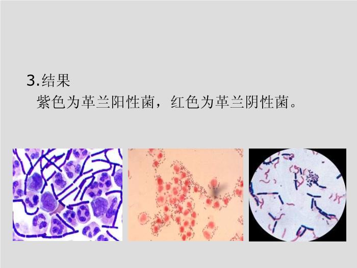 【醫學PPT課件】臨床微生物學檢驗技術 安徽醫科大學   徐元宏第8頁