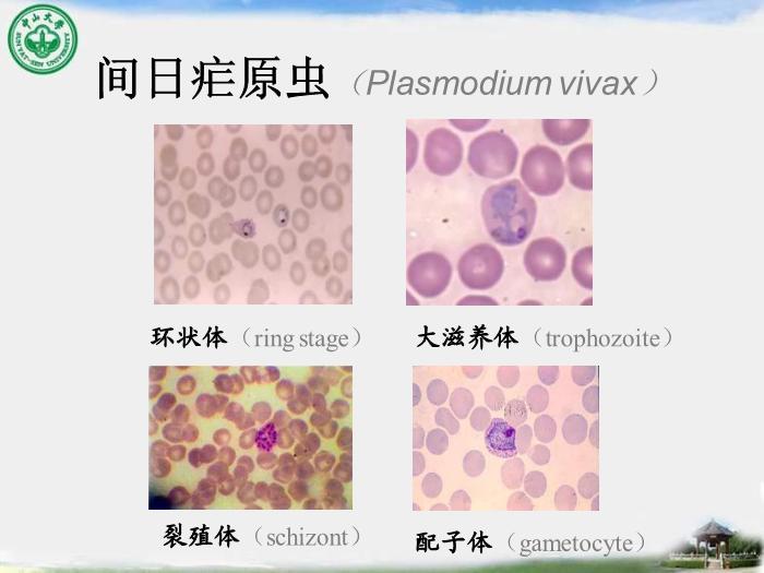 【醫學PPT課件】瘧疾 中山大學傳染病學教學課件第10頁