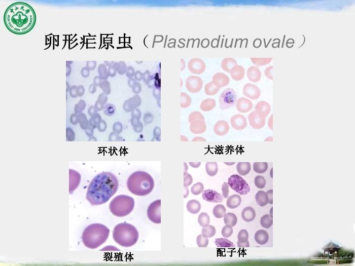 【醫學PPT課件】瘧疾 中山大學傳染病學教學課件第11頁