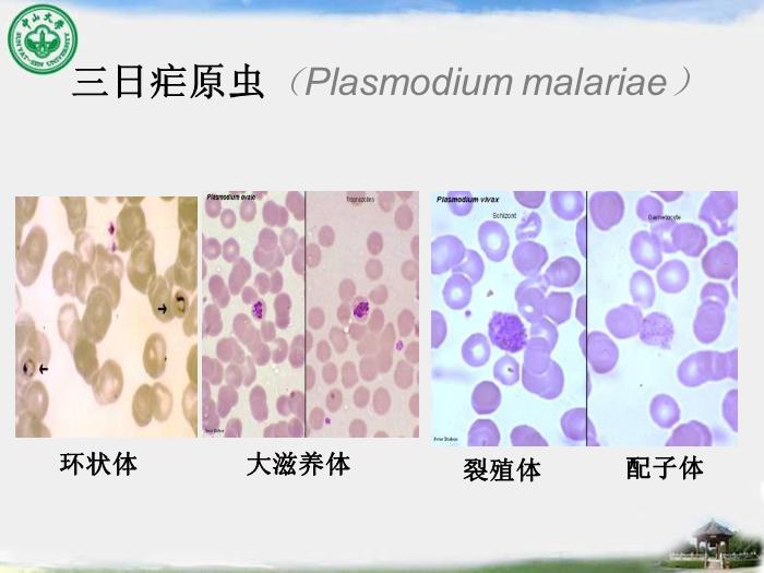 【醫學PPT課件】瘧疾 中山大學傳染病學教學課件第12頁