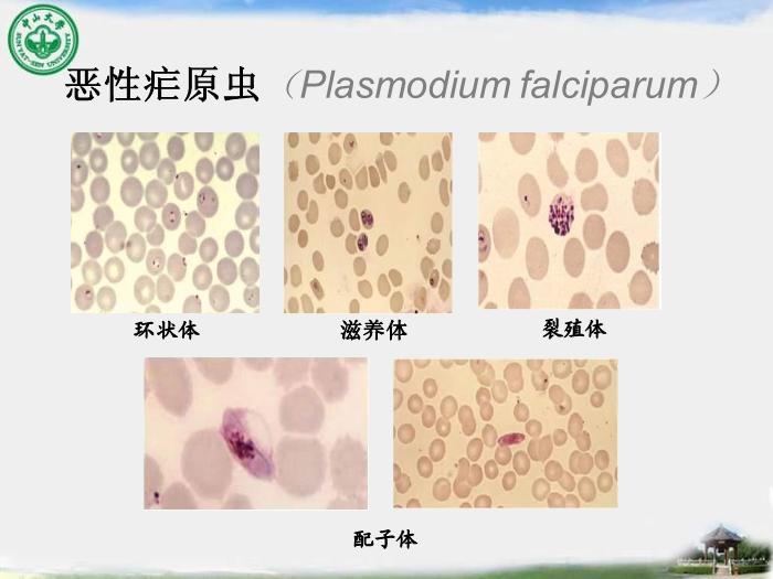 【醫學PPT課件】瘧疾 中山大學傳染病學教學課件第13頁