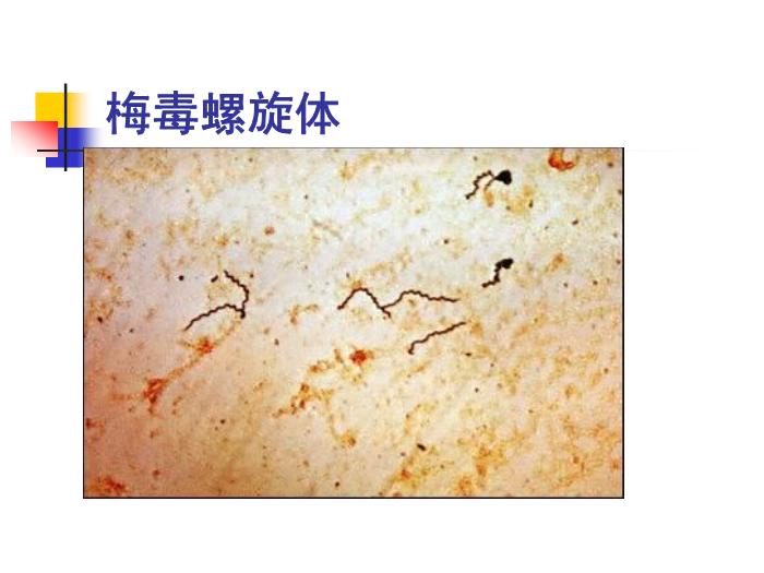 【醫學PPT課件】梅毒 鄭州大學傳染病學教學課件第6頁