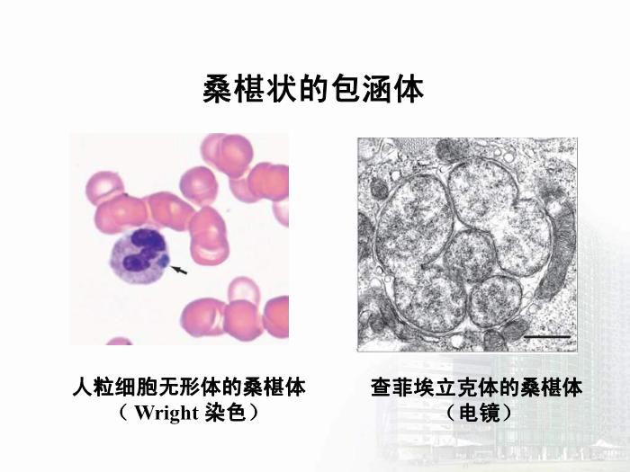 【醫學PPT課件】立克次體 醫學微生物學中南大學基礎醫學院第8頁